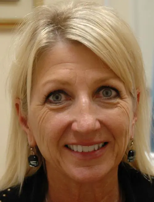 Botox-Dysport09 Botox/Dysport Before and After Pictures Fort Lauderdale, FL