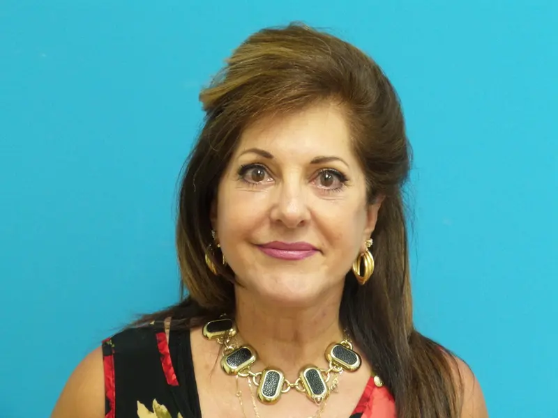 Facelift-pt23-front-after Facelift Before and After Pictures Fort Lauderdale, FL