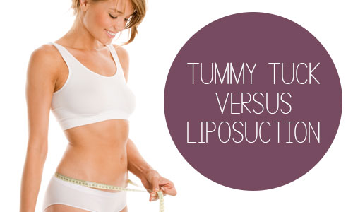 Tummy Tuck near Fort Lauderdale, FL