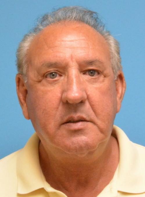 Face-Lift-22 Facelift Before and After Pictures Fort Lauderdale, FL