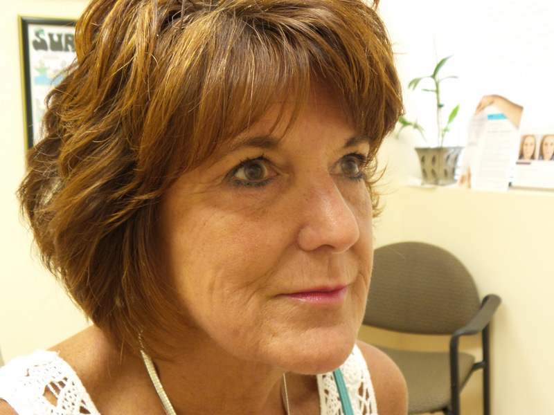 After 1 Fillers Before and After Pictures Fort Lauderdale, FL