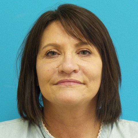 facelift-case20-front-after Facelift Before and After Pictures Fort Lauderdale, FL