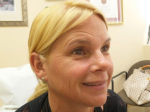 Botox/Dysport Before and After Pictures Fort Lauderdale, FL