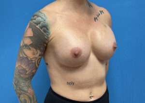 37 yo G1P1 5'7