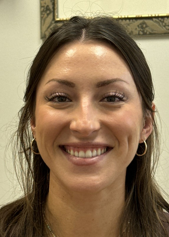 07242024 171800 (2) Combination Injectable Treatments Before and After Pictures Fort Lauderdale, FL